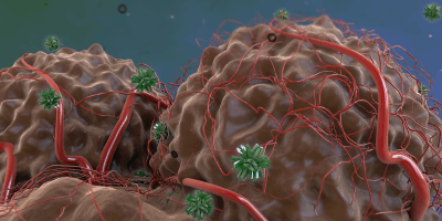 Dr. Rollins Articles 32 Tumor Markers, Oncotrace