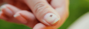 Health Insights 8 Disulfiram for Lyme Disease Protocol