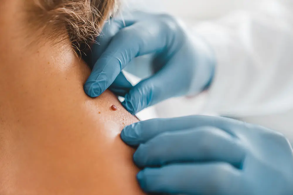 dermatologist examining patient